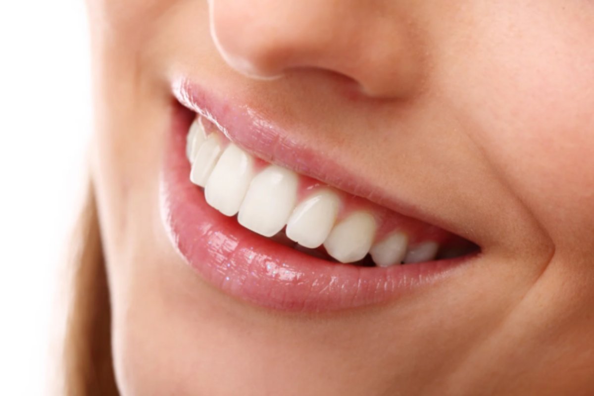 donna che sorride e mostra i denti bianchi